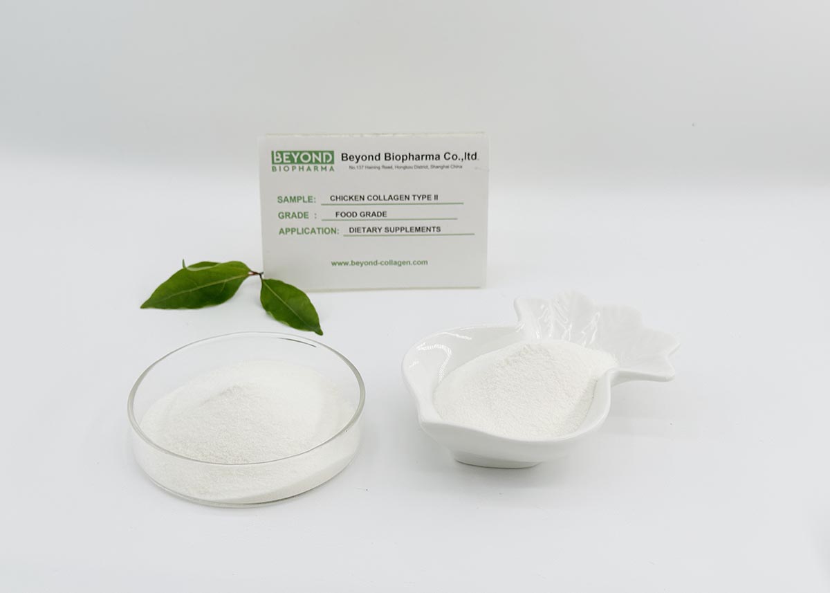 Undenatured Collagen Type II from Chicken Sternum Can Support Joint Health