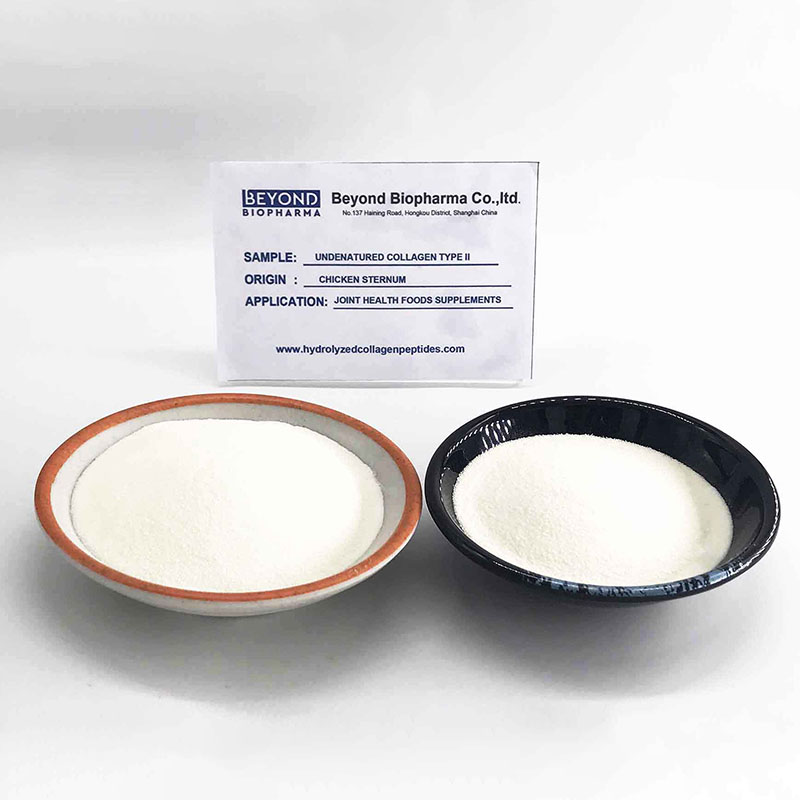 undenatured type ii collagen42